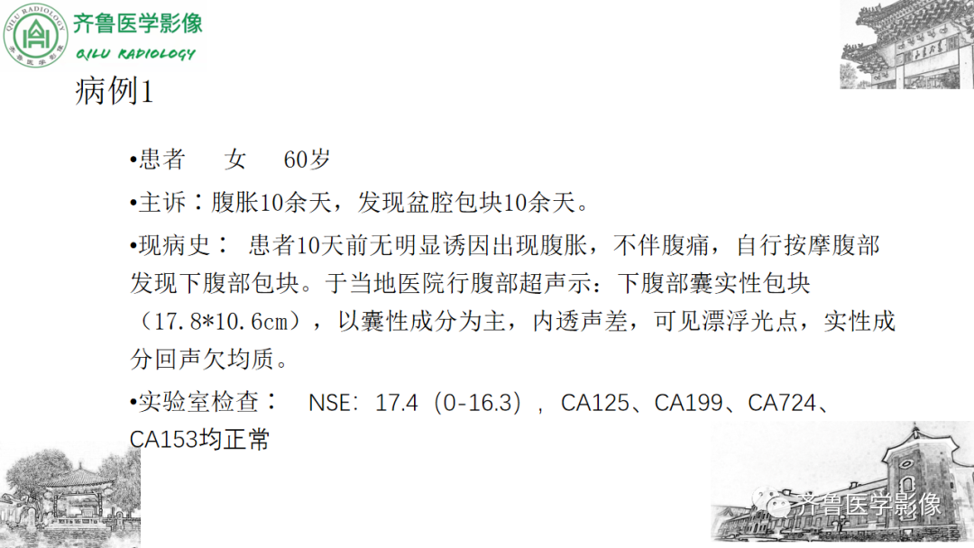 影像PPT - 【病例】卵巢透明细胞癌3例CT及MR影像-2