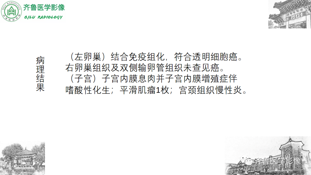 影像PPT - 【病例】卵巢透明细胞癌3例CT及MR影像-16
