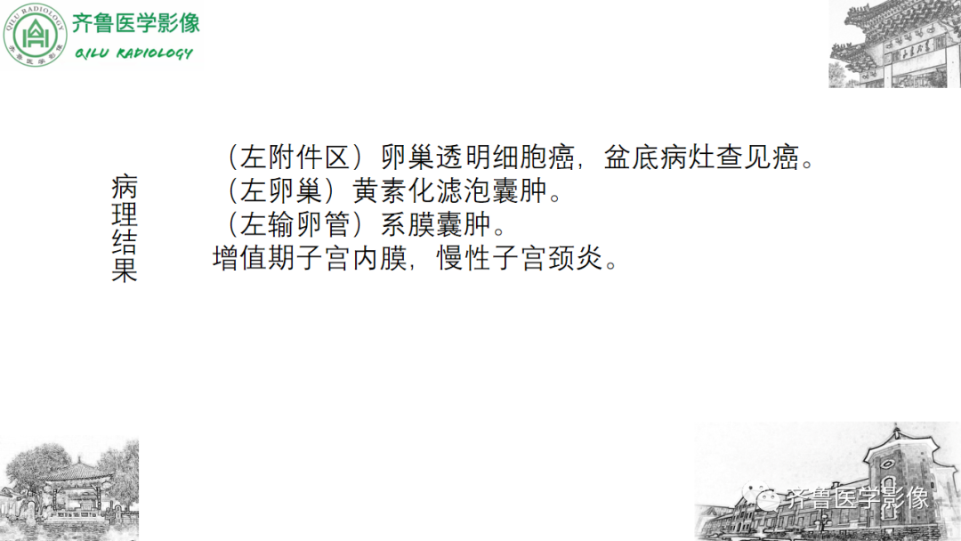 影像PPT - 【病例】卵巢透明细胞癌3例CT及MR影像-12