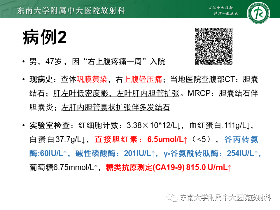 影像PPT - 【PPT】继发性肝内胆管局部扩张影像诊断思路-5