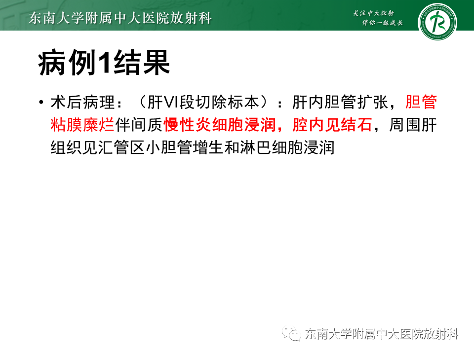 影像PPT - 【PPT】继发性肝内胆管局部扩张影像诊断思路-4