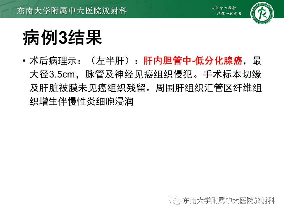 影像PPT - 【PPT】继发性肝内胆管局部扩张影像诊断思路-12