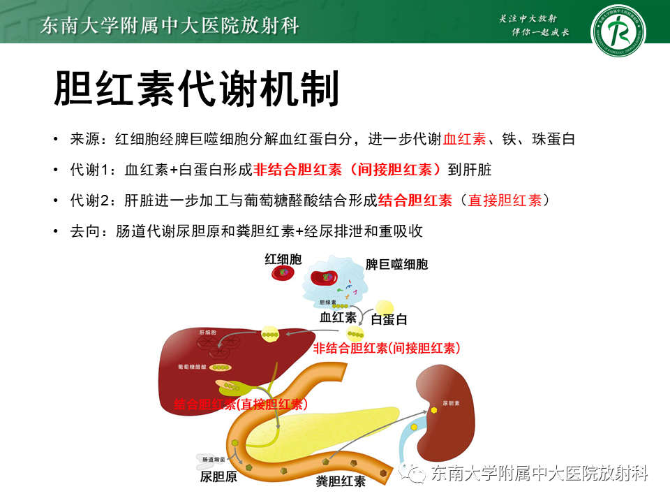 影像PPT - 【PPT】继发性肝内胆管局部扩张影像诊断思路-19