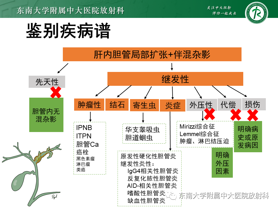 影像PPT - 【PPT】继发性肝内胆管局部扩张影像诊断思路-23