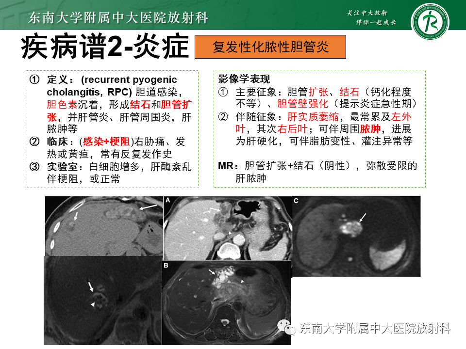 影像PPT - 【PPT】继发性肝内胆管局部扩张影像诊断思路-27