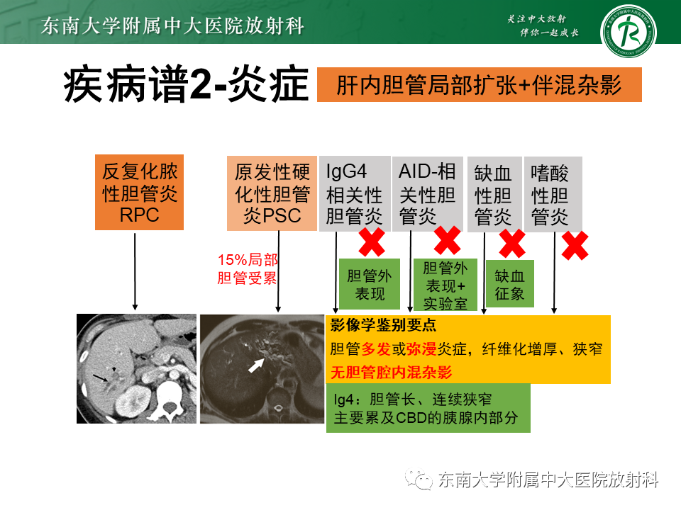 影像PPT - 【PPT】继发性肝内胆管局部扩张影像诊断思路-26