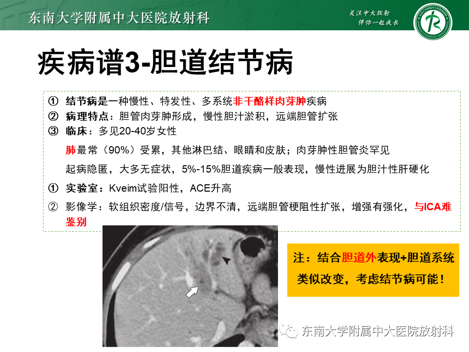 影像PPT - 【PPT】继发性肝内胆管局部扩张影像诊断思路-29