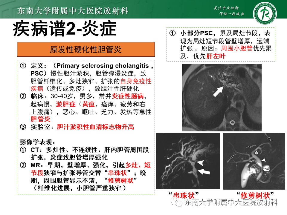 影像PPT - 【PPT】继发性肝内胆管局部扩张影像诊断思路-28