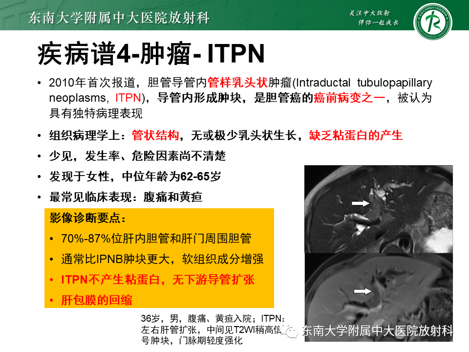 影像PPT - 【PPT】继发性肝内胆管局部扩张影像诊断思路-36