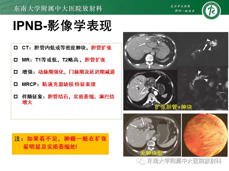 影像PPT - 【PPT】继发性肝内胆管局部扩张影像诊断思路-33