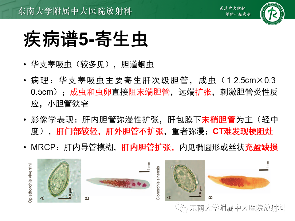 影像PPT - 【PPT】继发性肝内胆管局部扩张影像诊断思路-39