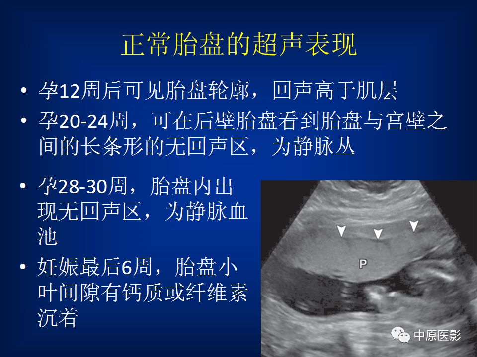 影像PPT - 【PPT】胎盘植入的MRI诊断-6