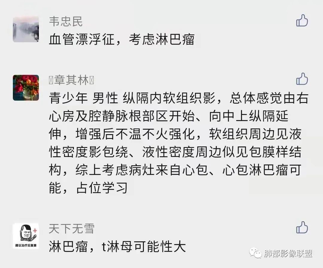 影像PPT - 【病例】纵隔/心脏毛霉菌病1例CT影像-26 影像PPT - 【病例】纵隔/心脏毛霉菌病1例CT影像-26