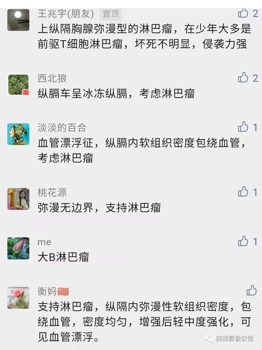 影像PPT - 【病例】纵隔/心脏毛霉菌病1例CT影像-25 影像PPT - 【病例】纵隔/心脏毛霉菌病1例CT影像-25