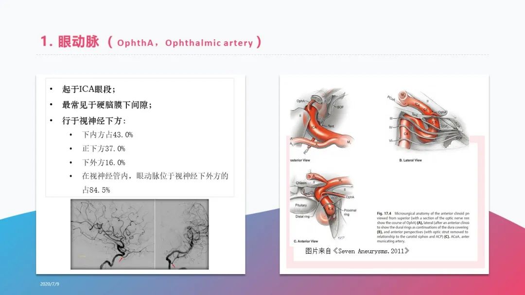 影像PPT - 【PPT】脑血管解剖-7 影像PPT - 【PPT】脑血管解剖-7