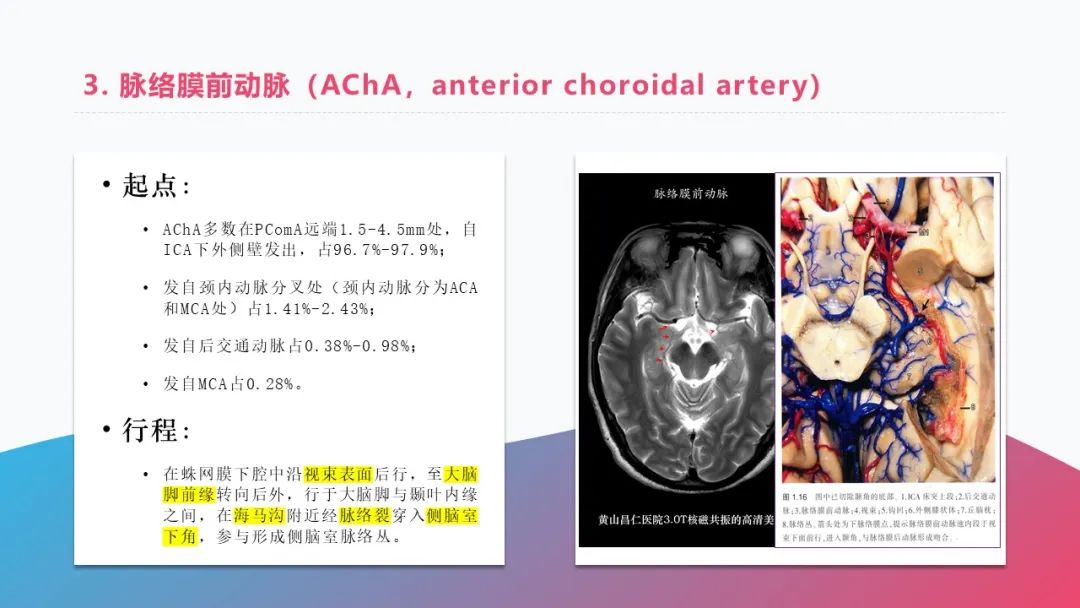 影像PPT - 【PPT】脑血管解剖-9 影像PPT - 【PPT】脑血管解剖-9