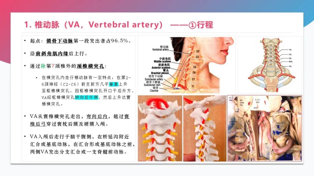 影像PPT - 【PPT】脑血管解剖-16 影像PPT - 【PPT】脑血管解剖-16
