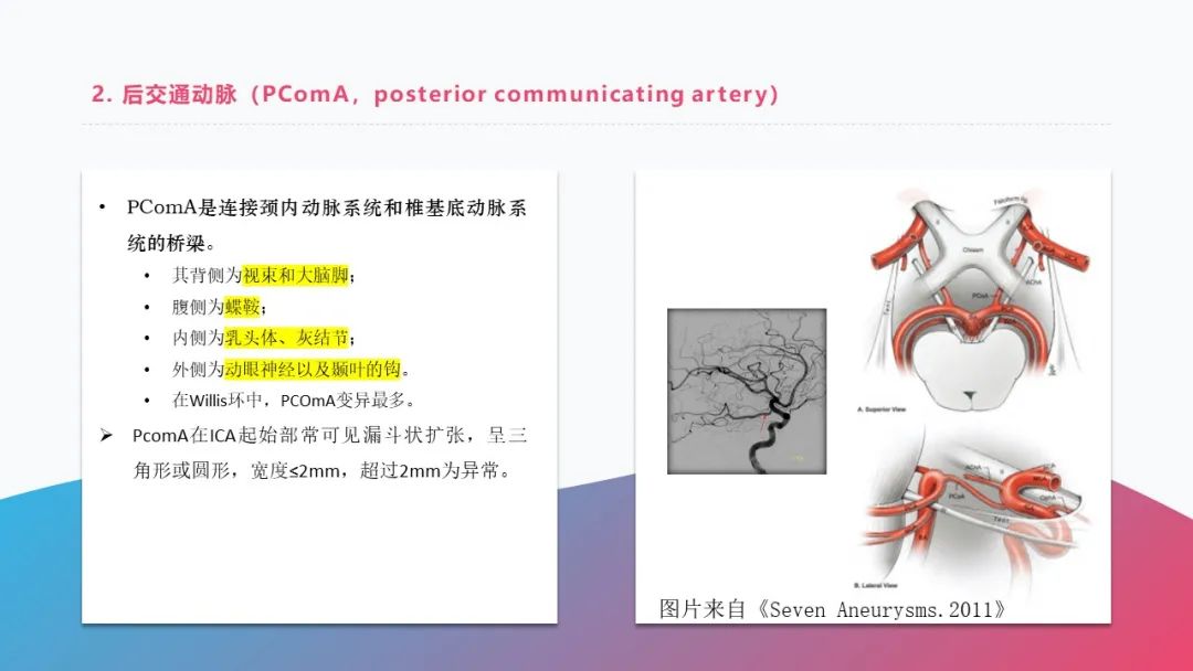 影像PPT - 【PPT】脑血管解剖-8 影像PPT - 【PPT】脑血管解剖-8