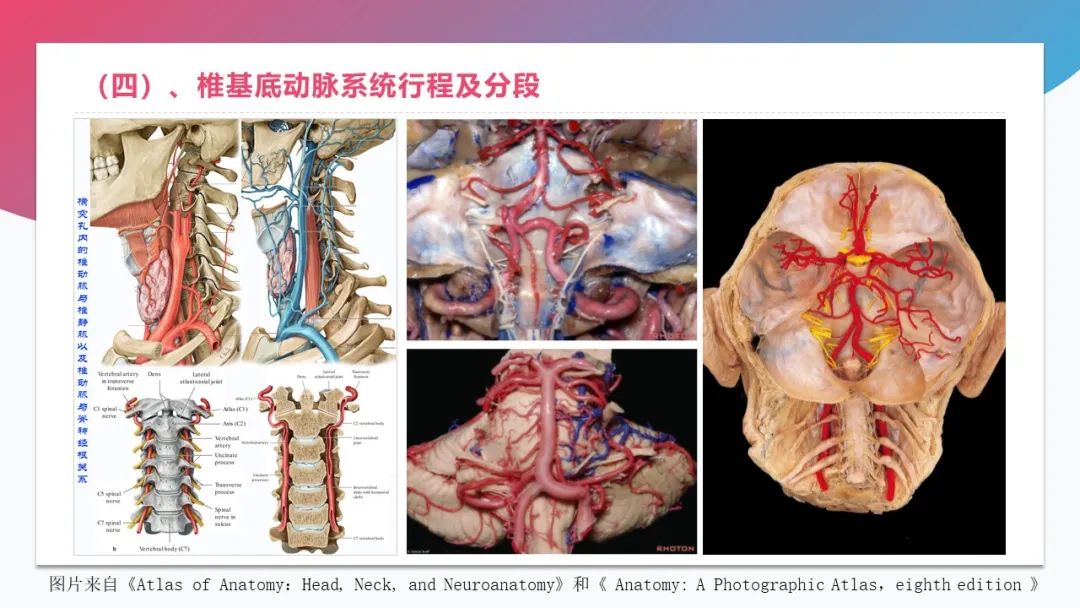 影像PPT - 【PPT】脑血管解剖-15 影像PPT - 【PPT】脑血管解剖-15