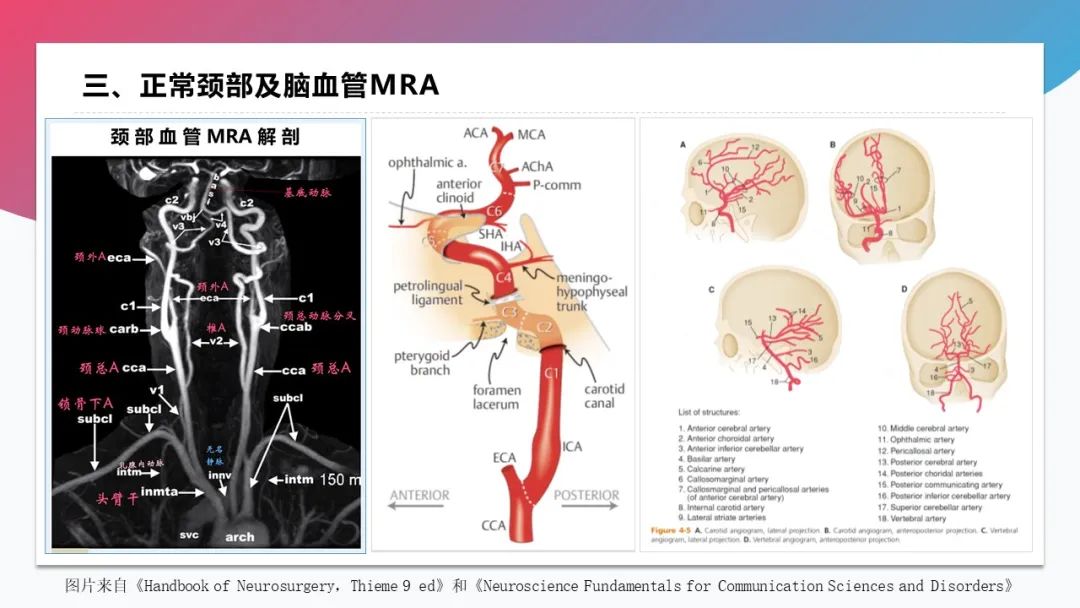 影像PPT - 【PPT】脑血管解剖-39 影像PPT - 【PPT】脑血管解剖-39