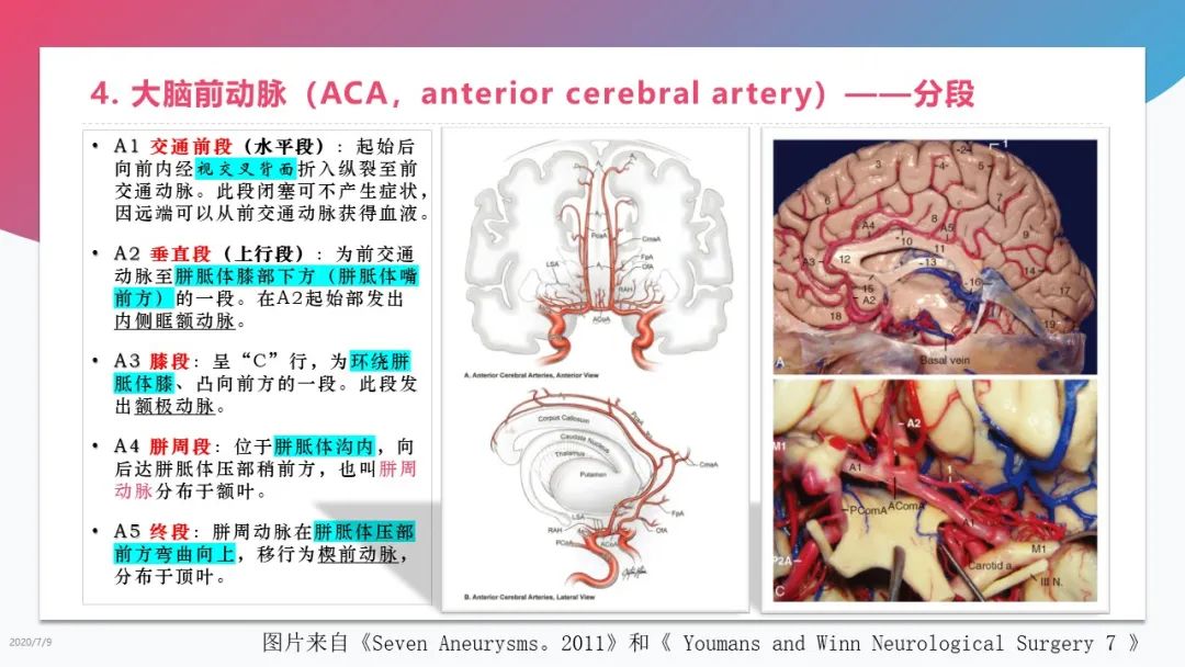 影像PPT - 【PPT】脑血管解剖-10 影像PPT - 【PPT】脑血管解剖-10