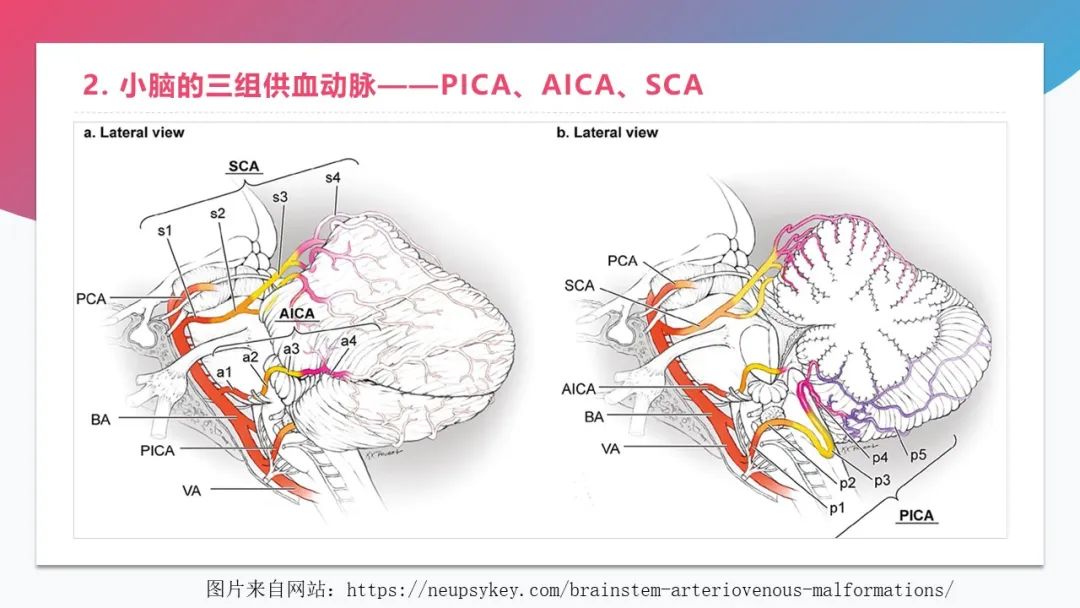影像PPT - 【PPT】脑血管解剖-23 影像PPT - 【PPT】脑血管解剖-23
