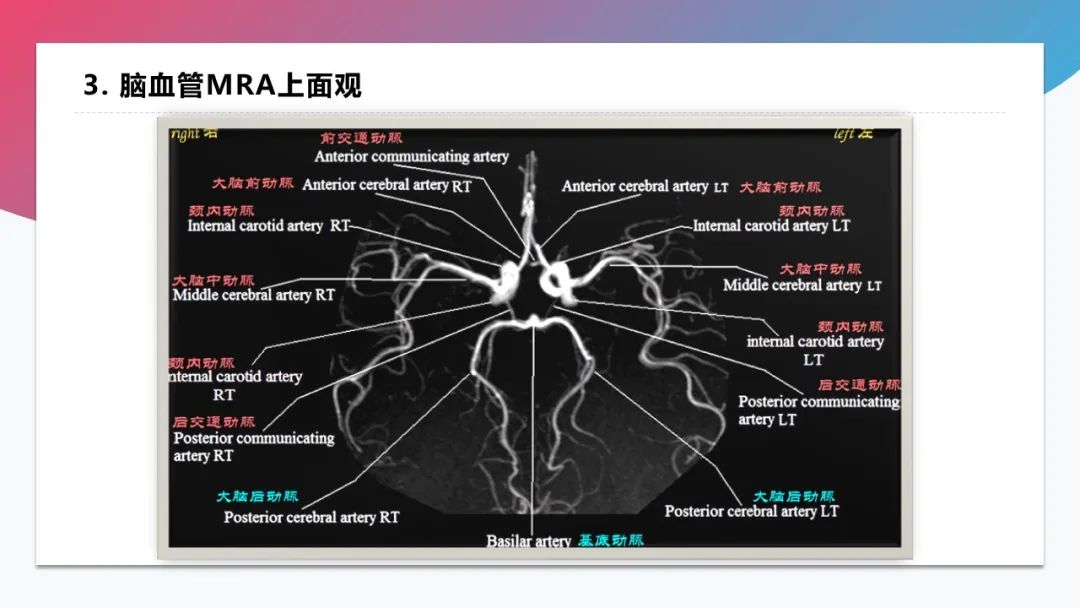 影像PPT - 【PPT】脑血管解剖-42 影像PPT - 【PPT】脑血管解剖-42