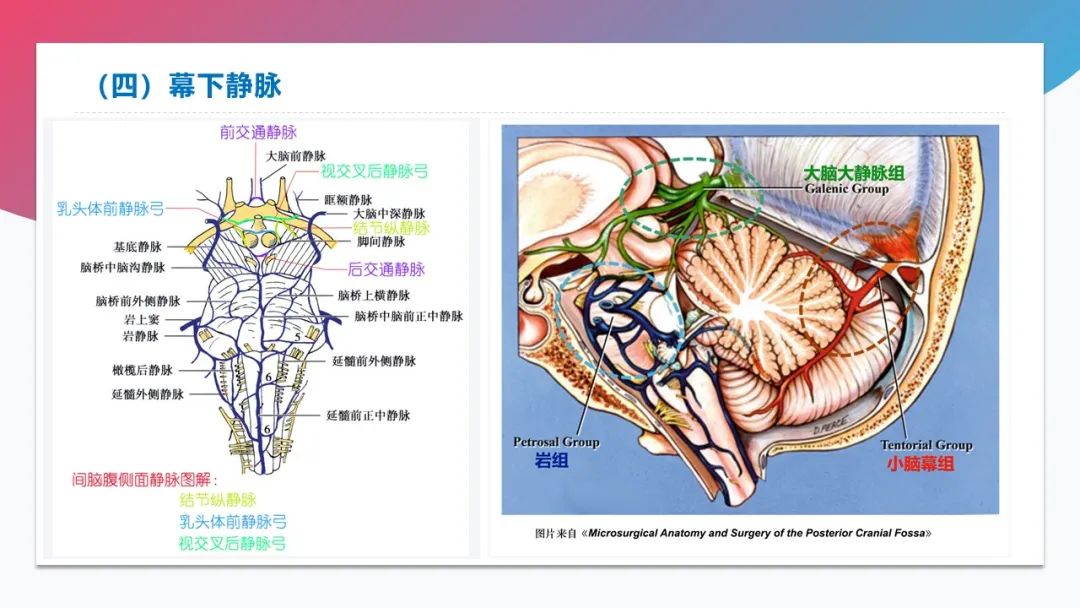 影像PPT - 【PPT】脑血管解剖-37 影像PPT - 【PPT】脑血管解剖-37