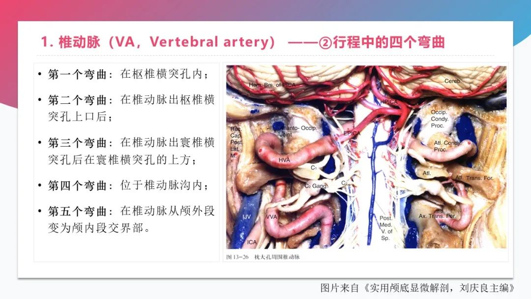 影像PPT - 【PPT】脑血管解剖-17 影像PPT - 【PPT】脑血管解剖-17