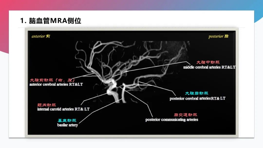 影像PPT - 【PPT】脑血管解剖-40 影像PPT - 【PPT】脑血管解剖-40