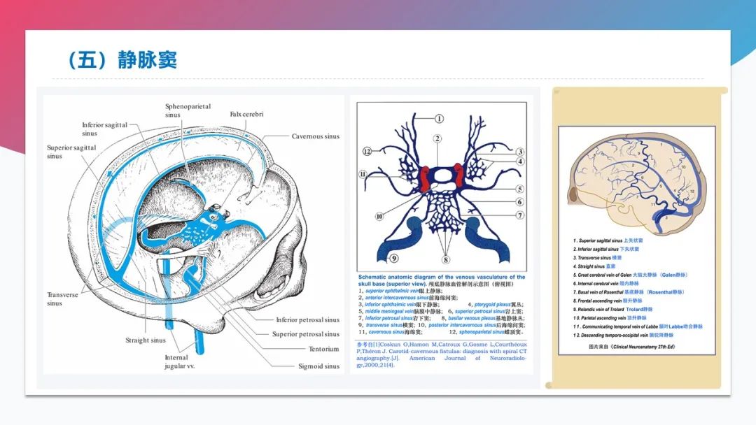 影像PPT - 【PPT】脑血管解剖-38 影像PPT - 【PPT】脑血管解剖-38