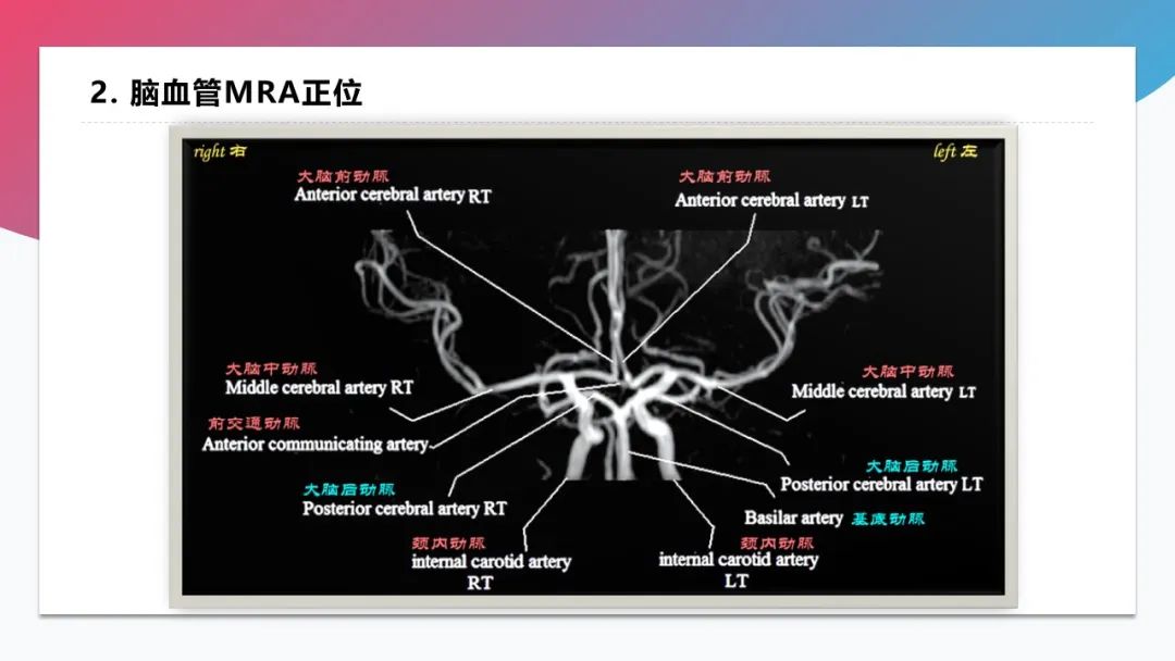 影像PPT - 【PPT】脑血管解剖-41 影像PPT - 【PPT】脑血管解剖-41