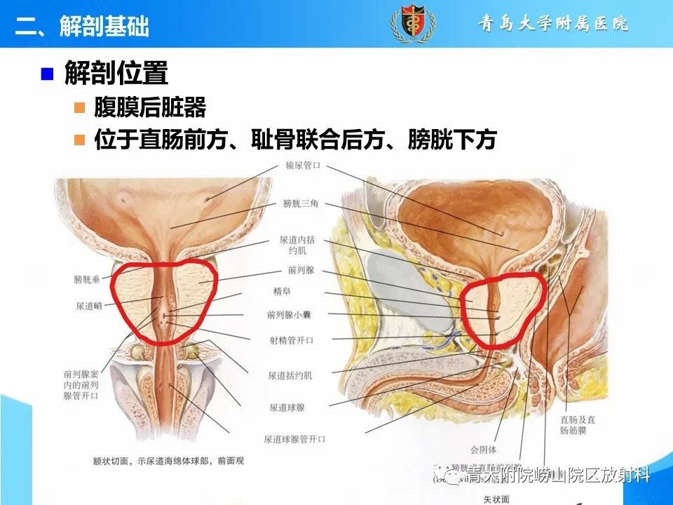 影像PPT - 【PPT】前列腺MRI解剖分区-4
