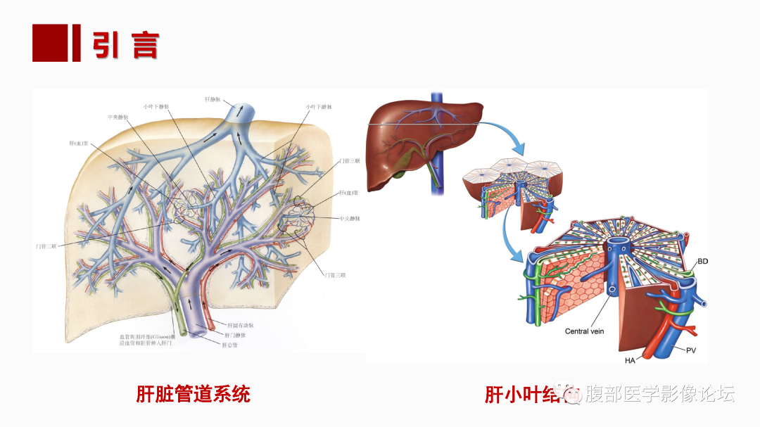 影像PPT - 【PPT】肝脏血管性病变影像学表现-6
