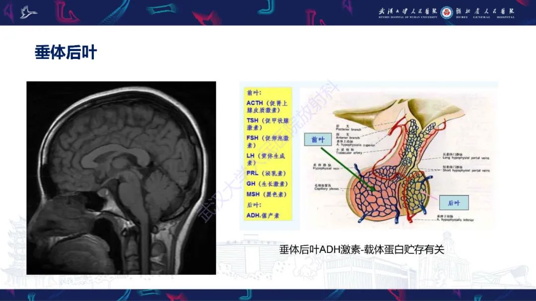 影像PPT - 【PPT】鞍区T1WI高信号病变影像诊断-7