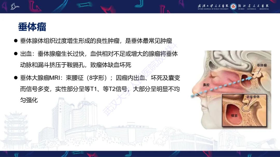 影像PPT - 【PPT】鞍区T1WI高信号病变影像诊断-11