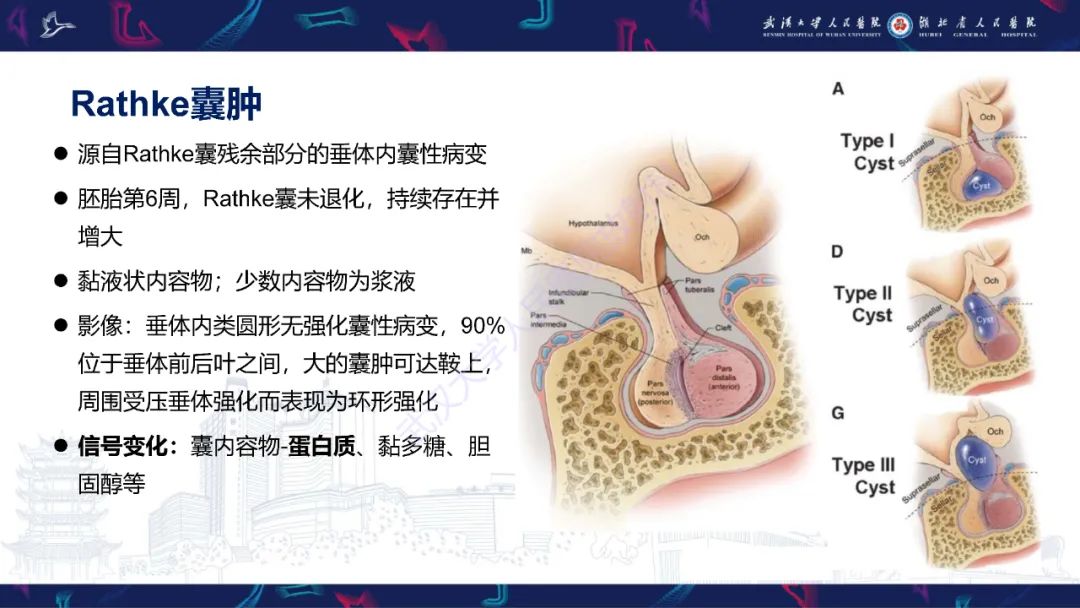 影像PPT - 【PPT】鞍区T1WI高信号病变影像诊断-22