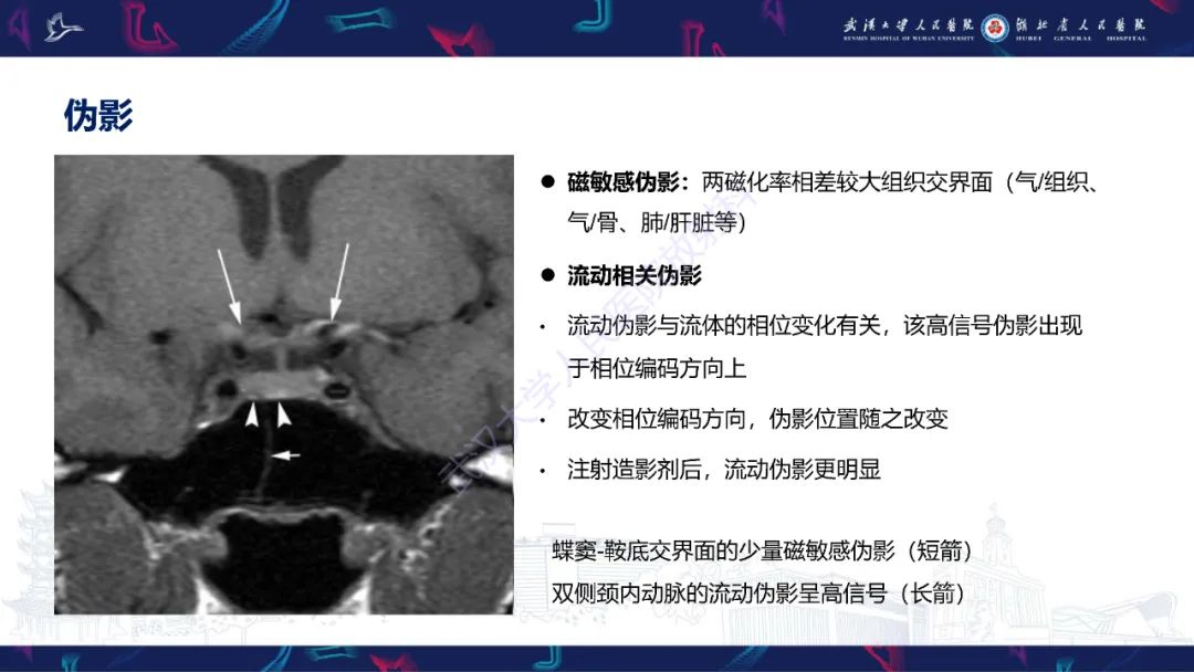 影像PPT - 【PPT】鞍区T1WI高信号病变影像诊断-55