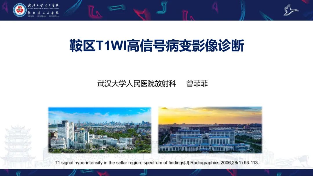 影像PPT - 【PPT】鞍区T1WI高信号病变影像诊断-1