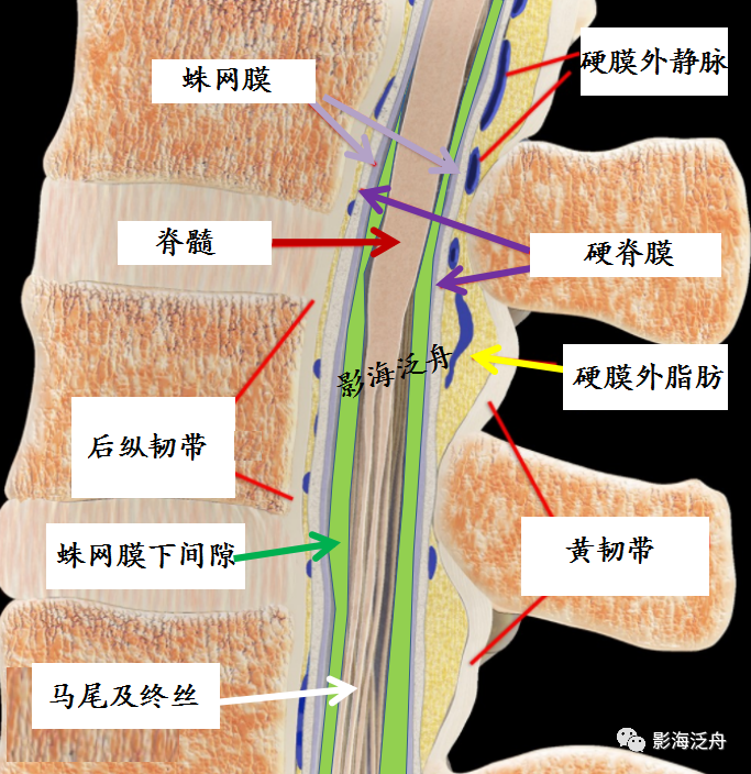 影像PPT - 椎管内硬膜外脂肪增多症-10 影像PPT - 椎管内硬膜外脂肪增多症-10
