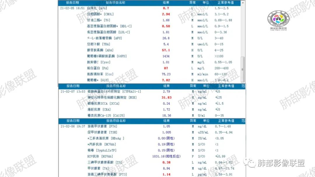 影像PPT - 【病例】马儿尼菲篮状菌1例肺部CT影像-4 影像PPT - 【病例】马儿尼菲篮状菌1例肺部CT影像-4