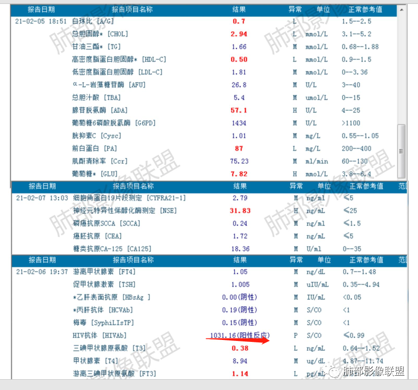 影像PPT - 【病例】马儿尼菲篮状菌1例肺部CT影像-32 影像PPT - 【病例】马儿尼菲篮状菌1例肺部CT影像-32