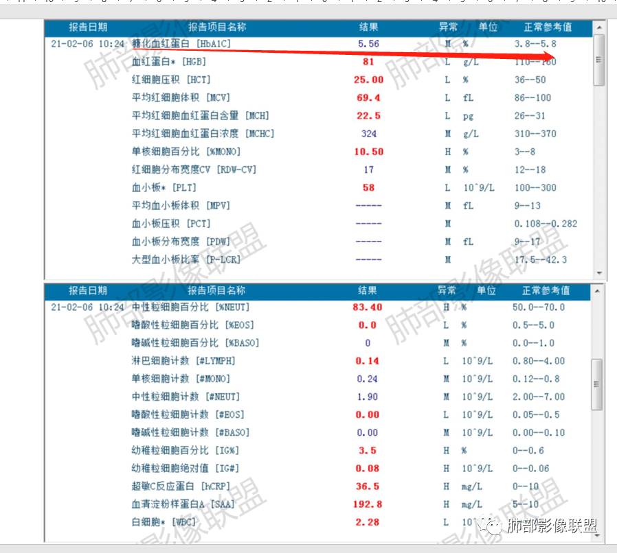 影像PPT - 【病例】马儿尼菲篮状菌1例肺部CT影像-40 影像PPT - 【病例】马儿尼菲篮状菌1例肺部CT影像-40