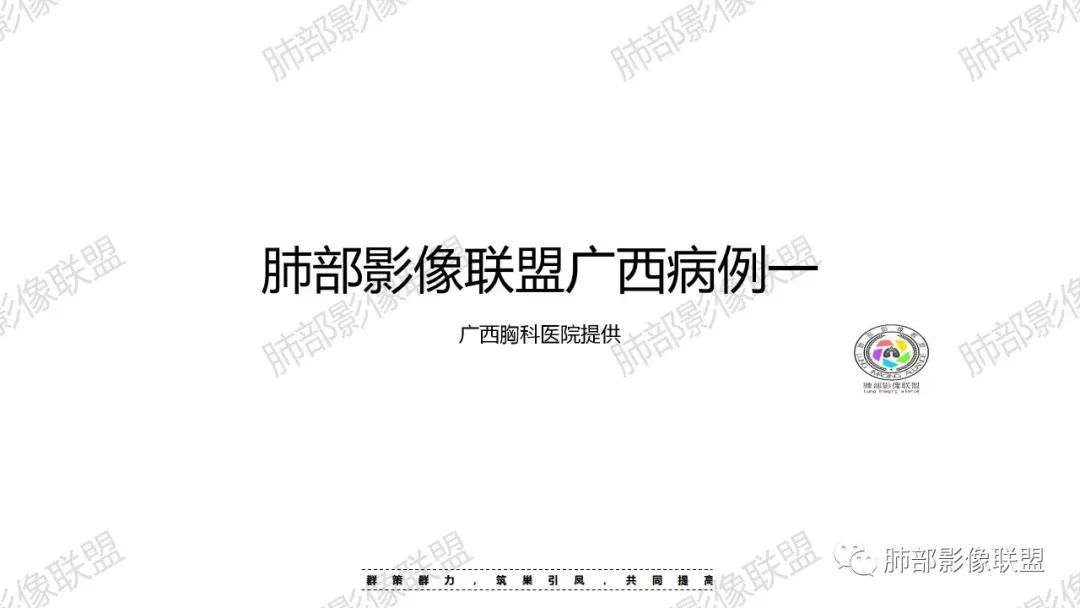 影像PPT - 【病例】马儿尼菲篮状菌1例肺部CT影像-1 影像PPT - 【病例】马儿尼菲篮状菌1例肺部CT影像-1