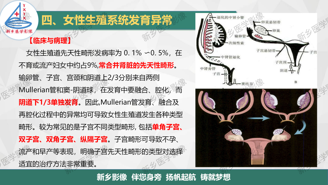 影像PPT - 【PPT】女性生殖解剖、发育畸形影像表现-16