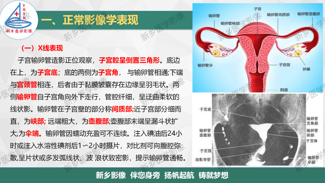 影像PPT - 【PPT】女性生殖解剖、发育畸形影像表现-3