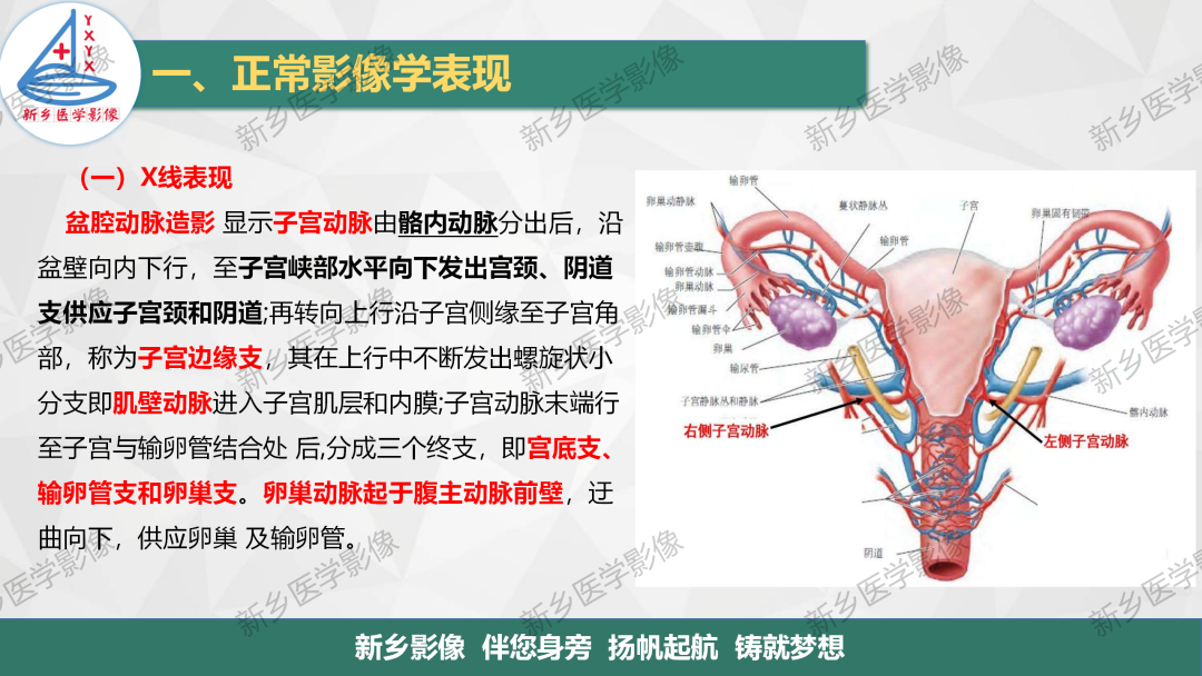 影像PPT - 【PPT】女性生殖解剖、发育畸形影像表现-2
