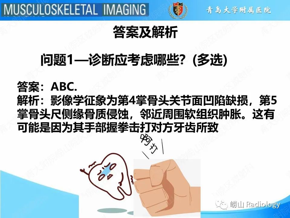 影像PPT - 【PPT】掌骨撞击牙齿骨折-4
