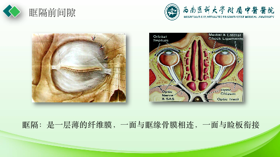 影像PPT - 【PPT】眼部常见疾病影像学定位诊断-4