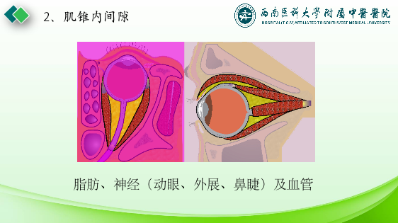 影像PPT - 【PPT】眼部常见疾病影像学定位诊断-7